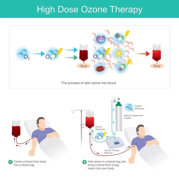 high dose ozone therapy graphic