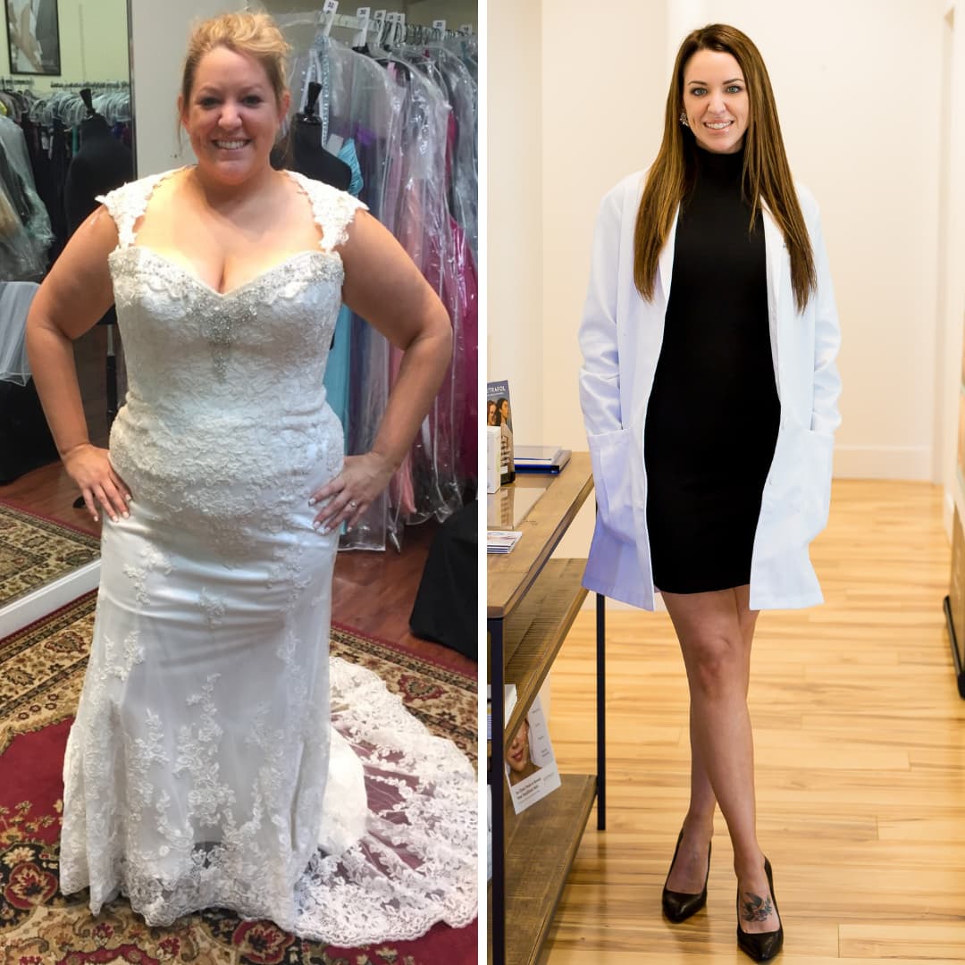 My Personal Weight Loss Story and my thoughts on Ozempic